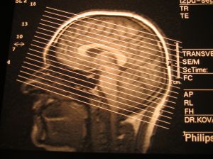 666037_x-ray_head.jpg