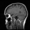 mri-head-scan-370098-s.jpg