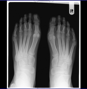 xray-1319306-m.jpg